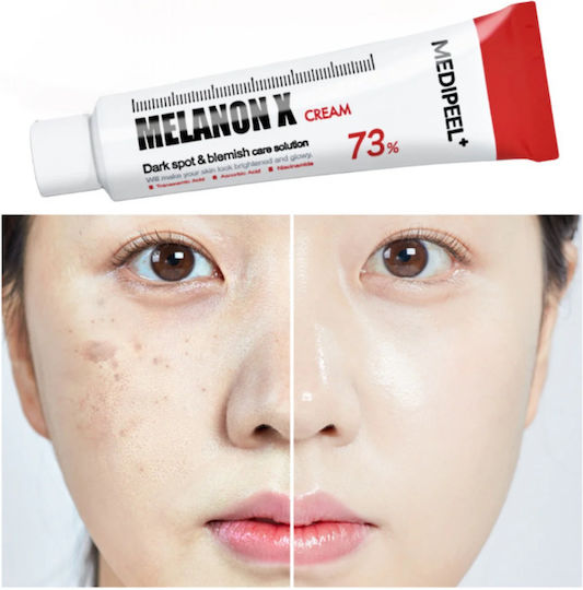Medi Peel Melanon X 24ωρη Κρέμα Προσώπου για Πανάδες & Ρύθμιση Λιπαρότητας με Υαλουρονικό Οξύ & Βιταμίνη C 30ml