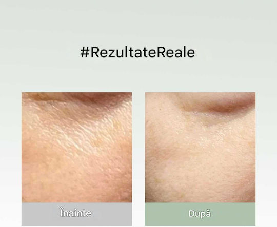 Arencia Mască Facială