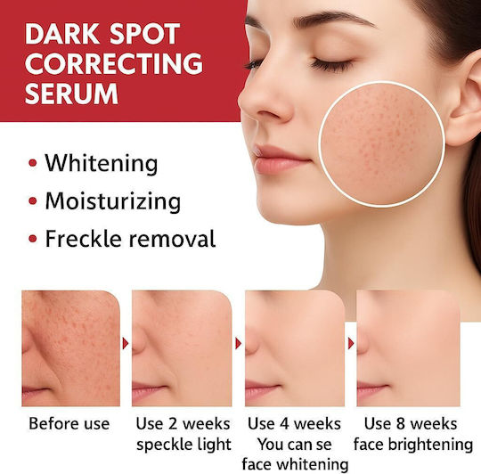 Anua Niacinamide 10%+TXA 4% Ενυδατικό Serum Προσώπου με Νιασιναμίδη & Υαλουρονικό Οξύ για Λάμψη & Πανάδες 30ml