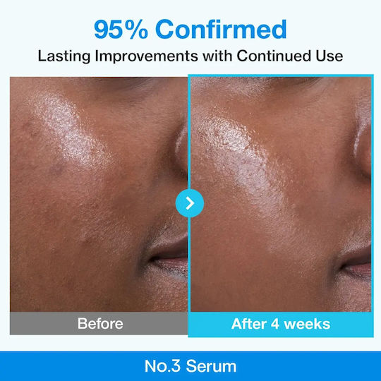 Numbuzin No.3 Синя Bio-Retinol Есенция за Лице с Ниацинамид за Стягане на Кожата 30ml