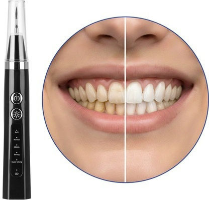 Ultrasonic Ηλεκτρική Οδοντόβουρτσα Μαύρη