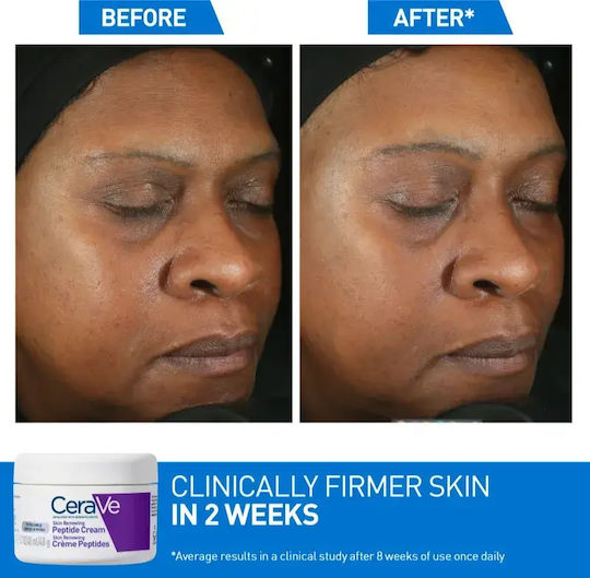 CeraVe Skin Renewing Creme Gesicht Nacht 48gr