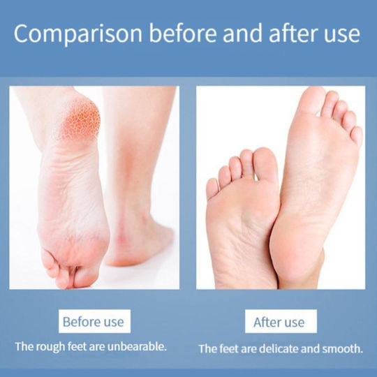 Roza Professional Pedicure Set 8 in 1 Blue – Callus & Dead Skin Removal