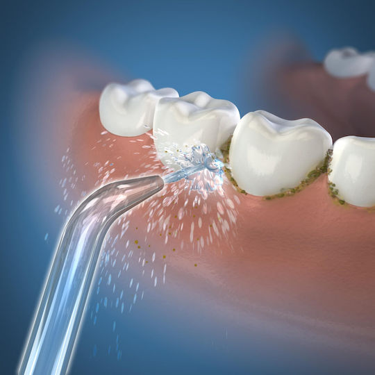 Waterpik Класическа Jet Насадка Резервни Части За 2 Бр
