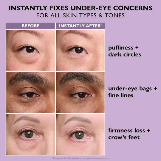 Peter Thomas Roth Instant FIRMx Eye Σετ Περιποίησης για Αντιγήρανση & Σύσφιξη 2τμχ