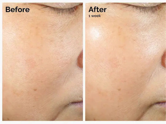 Ordinary Rice Lipids + Ectoin Microemulsion Lightweight Moisturizing Emulsion Capacity Ml 120