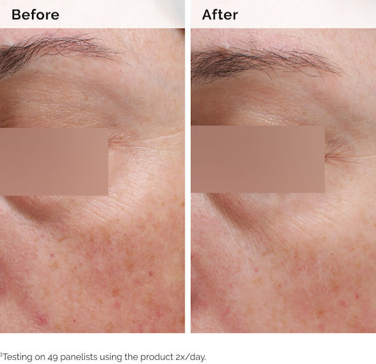 The Ordinary Niacinamide 5% Moisturizing Body Serum against Dark Spots with Niacinamide 100ml
