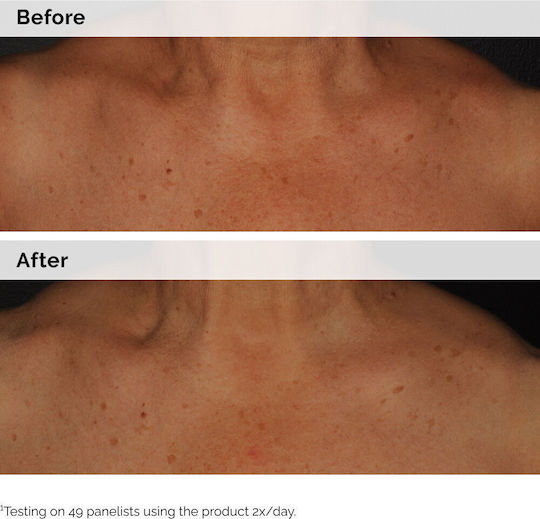 The Ordinary Niacinamide 5% Moisturizing Body Serum against Dark Spots with Niacinamide 100ml