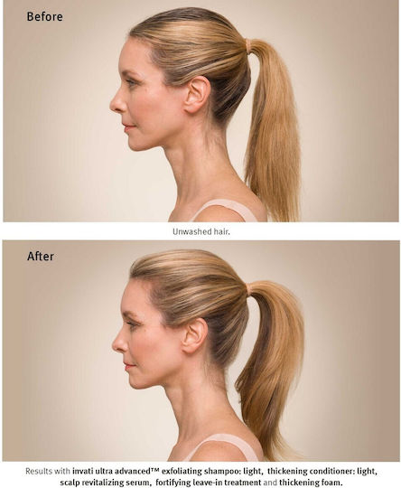 Aveda Invati Conditioner κατά της Τριχόπτωσης για Λεπτά Μαλλιά 200ml
