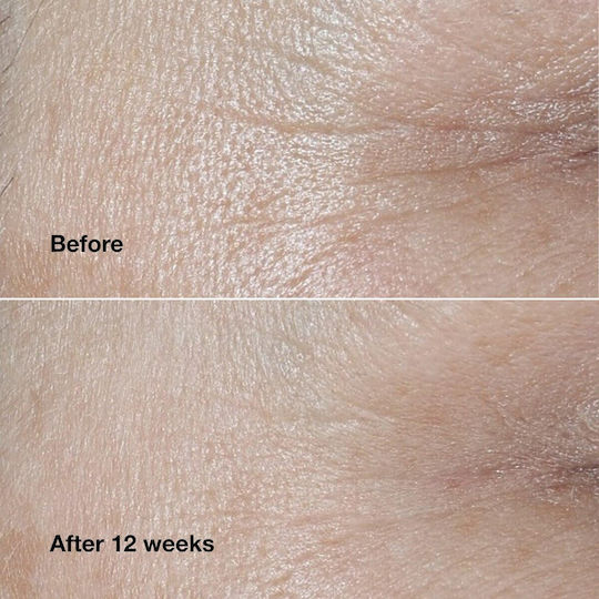 Clinique Wrinkle Fighting Routine Σετ Περιποίησης για Αντιγήρανση