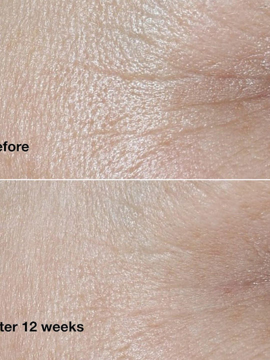 Clinique De-Aging Experts Kosmetik-Set Hautpflege-Set für Anti-Aging