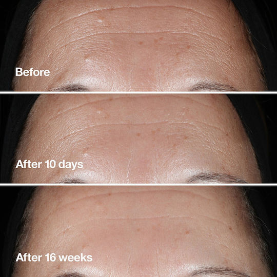 Clinique Lift+Smooth Routine Σετ Περιποίησης για Αντιγήρανση & Σύσφιξη 4τμχ