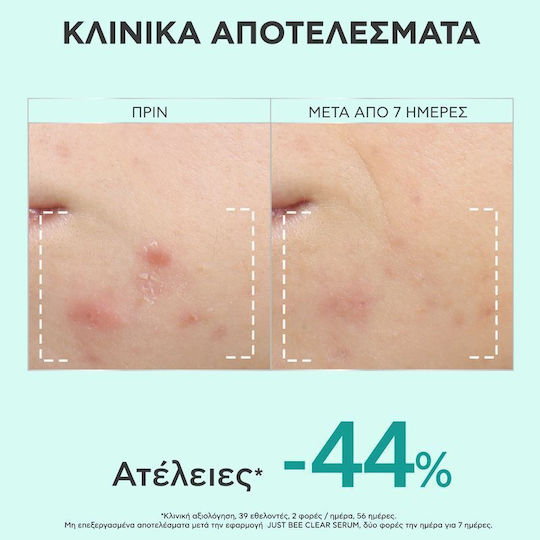 Apivita Bee Tech Concentrates Just Bee Clear Serum Face with Salicylic Acid for Acne & Imperfections 30ml