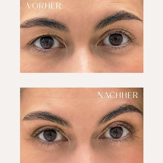 Parsa Eyelid Tape Set – Σετ Αυτοκόλλητες Ταινίες Ανόρθωση Βλεφάρων Εργαλεία Εφαρμογής 3τεμ