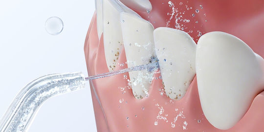 Dreame Water Flosser με Αισθητήρα Πίεσης Λευκό