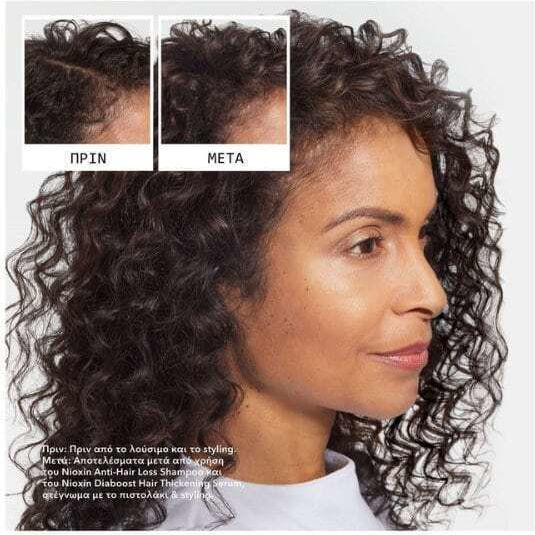 Nioxin Anti-hair Loss Sampon împotriva căderii părului 240ml