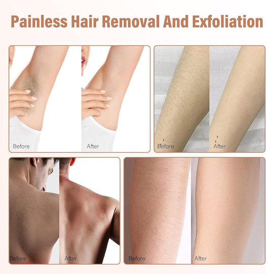 Schmerzfreie Epiliergerät Kristall Peeling Unisex