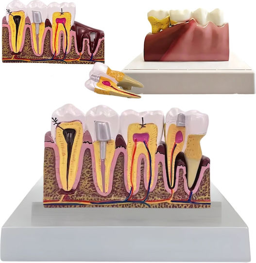 Model Anatomical De Dinți Matriță Model Oral Realist Model Dentar Cabinet Stomatologic Demonstrații Dentare Școală Dentară Bază Dimensiune 16.1 X 12.5 Cm Matriță 13.8 X 8.5 Cm Material Rășină Multicolor