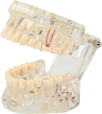 Model Dentar Anatomie Maxilară Dinți