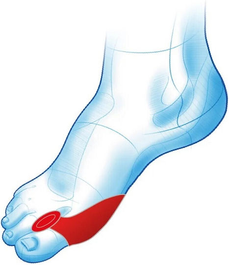 Set of 2 Protective Silicone Toe Separator Foot Pads Bunion