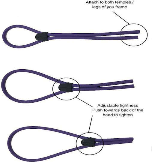 Centrostyle Adjustable Retainer Band Blue