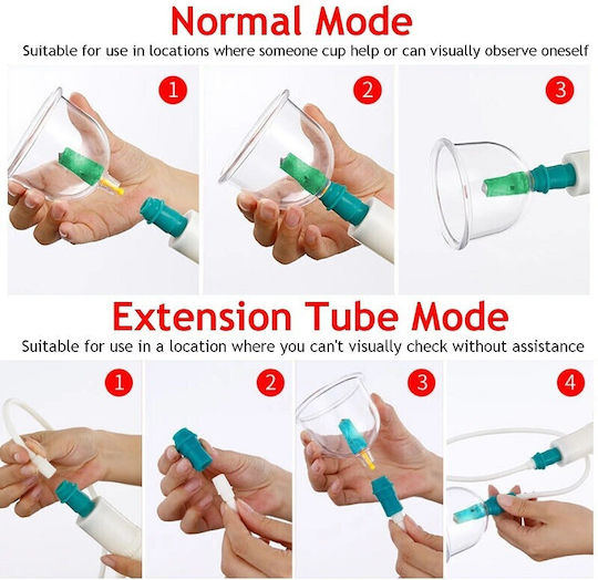 Set of 18 Traditional Therapy Suction Cups