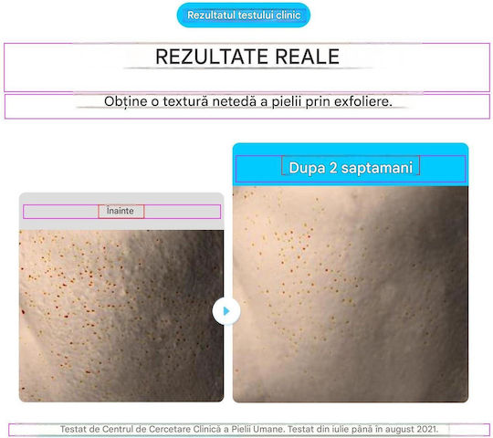 Eqqualberry Dischete Tonice Pentru Față cu Centella Asiatica, Niacinamidă & Pantenol 300ml