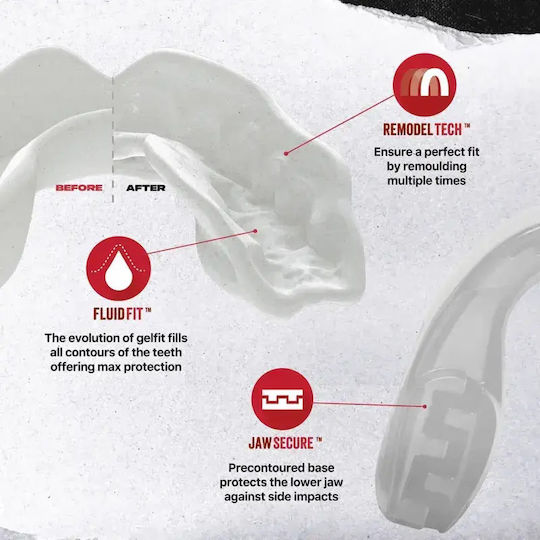 Kids Mouth Guards Safejawz Mouth Guard “intro” Code 219 Case