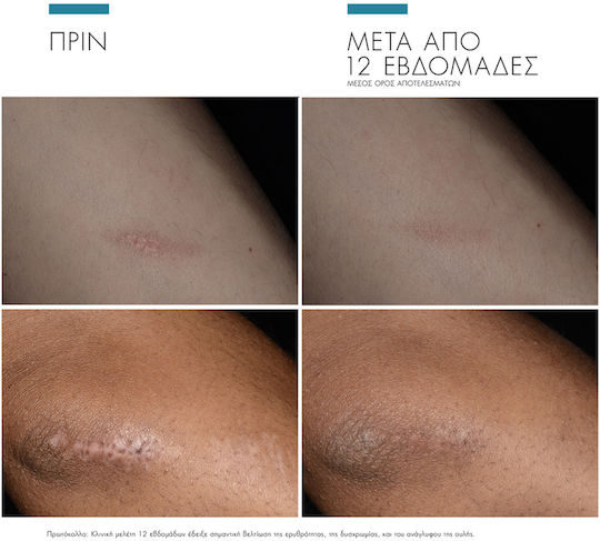 SkinCeuticals Advanced Scar Control Cream Face Day 50ml