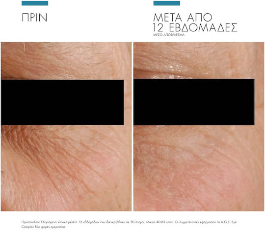 SkinCeuticals Correct Κρέμα Ματιών για Αντιγήρανση , Σακούλες , Λάμψη & Μαύροι Κύκλοι 15ml
