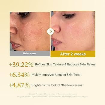 Medicube Kojic Acid Turmeric Lotion Τόνωσης Προσώπου με Γλυκολικό Οξύ & AHA