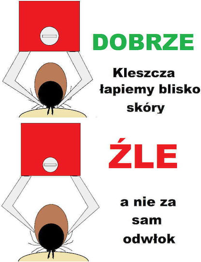 Pensetă pentru îndepărtarea căpușelor pentru câini și pisici Trixie
