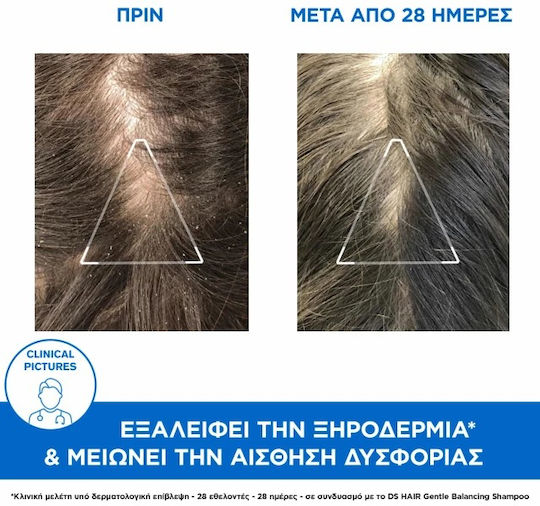 Uriage D S Hair Anti Σαμπουάν κατά της Πιτυρίδας για Λιπαρά Μαλλιά 500ml