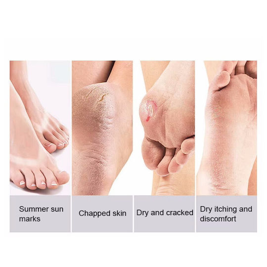 Balm for Cracked Heels 80gr