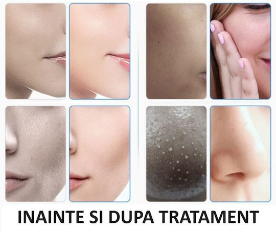 Electro Ag Dispozitiv de Rejuvenare Facială 7 în 1 Dispozitiv de Dermabraziune CC71