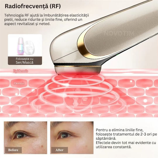 Dispozitiv Profesional 6 În 1 Pentru Tratament Facial Rejuvenare A Pielii Mr168 4 Funcții Mezoterapie Rf Led Lifting Anti Rid Ems Vibrații Microcurent Îngrijire A Porilor Masaj Facial Auriu