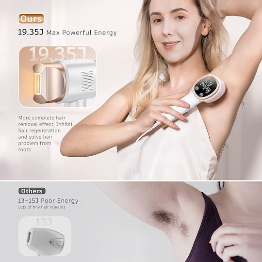 Aminzer Epilator IPL X001QG9PR9