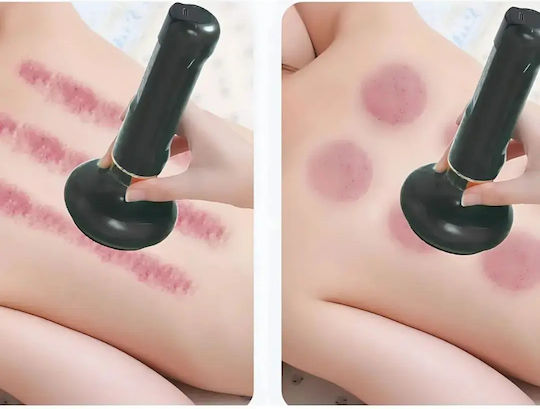 Electric Massage Suction Cup USB Adjustable 6-Level Suction