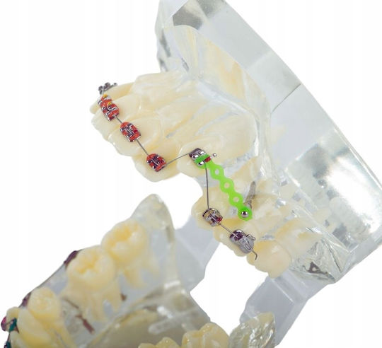Dental Model Device 100 60