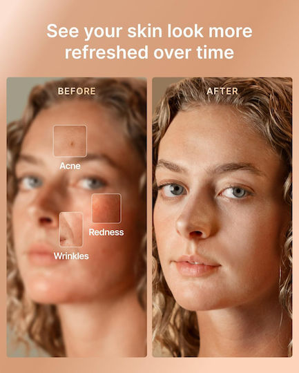Renpho Renpho Artemis Blush Gesichtspflegegerät Maske für Phototherapie des Gesichts