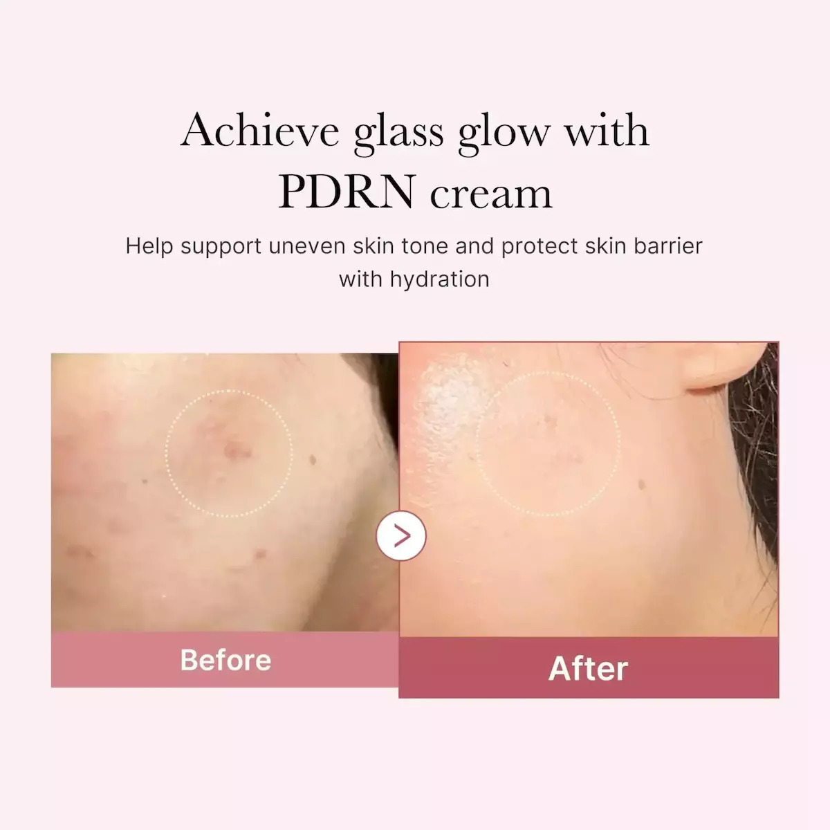 Medicube PDRN Pink Hyaluronic Κρέμα Προσώπου για Ενυδάτωση & Ατέλειες με Υαλουρονικό Οξύ & Νιασιναμίδη 50ml