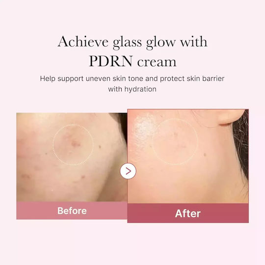 Medicube PDRN Pink Hyaluronic Крем за Лице за Хидратация и Несъвършенства с Хиалуронова Киселина и Ниацинамид 50ml