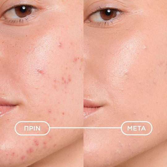 Bioderma Sébium Kérato+ Cover Tinted Gel Cream Against Imperfections for Acne-Prone Skin