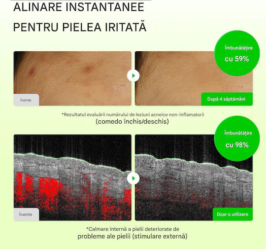 Eqqualberry Dischete Tonifiante pentru Față cu Centella Asiatica, Niacinamidă și Ceai Verde 150ml