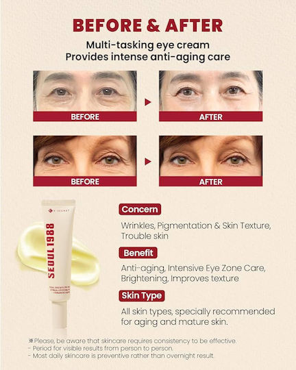 K-Secret Seoul 1988 Eye Cream for Anti-Aging, Hydration, Brightening & Eye Bags 30ml