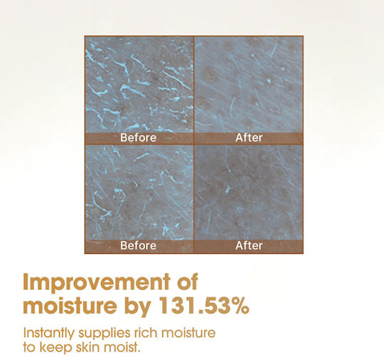 Galactomyces Pure Vitamin C Anti-Aging Serum Gesicht mit Vitamin C & Hyaluronsäure 30ml