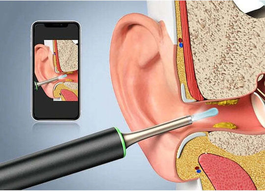 Bebird Otoscope with Digital Recording