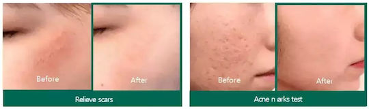 Some By Mi Snail Truecica Αντιγηραντικό Serum Προσώπου με Έκκριμα Σαλιγκαριού & Centella Asiatica 50ml