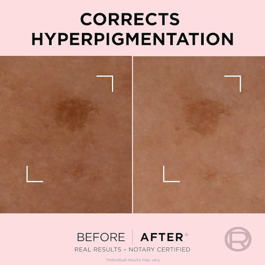 L'Oreal Paris Age Perfect Αντιγηραντικό Serum Προσώπου με Νιασιναμίδη 30ml