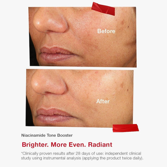 Essentials Even Tone Serum Booster For Face With Niacinamide For Brightening And Dark Spots 30ml